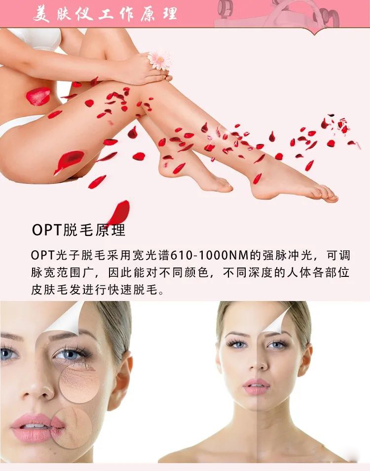 opt脫毛儀.jpg