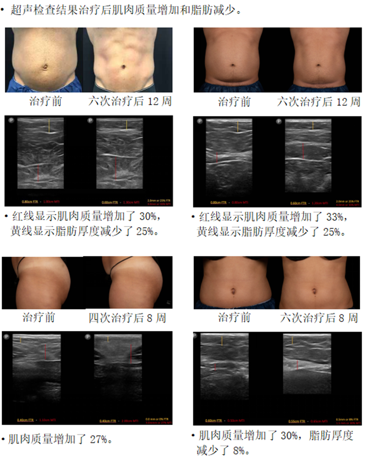 Trusculp 3D既塑儀器.7.png