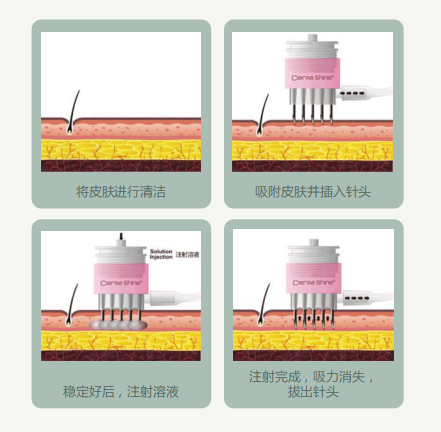 四代德瑪莎.png