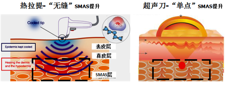 熱拉提.6.png